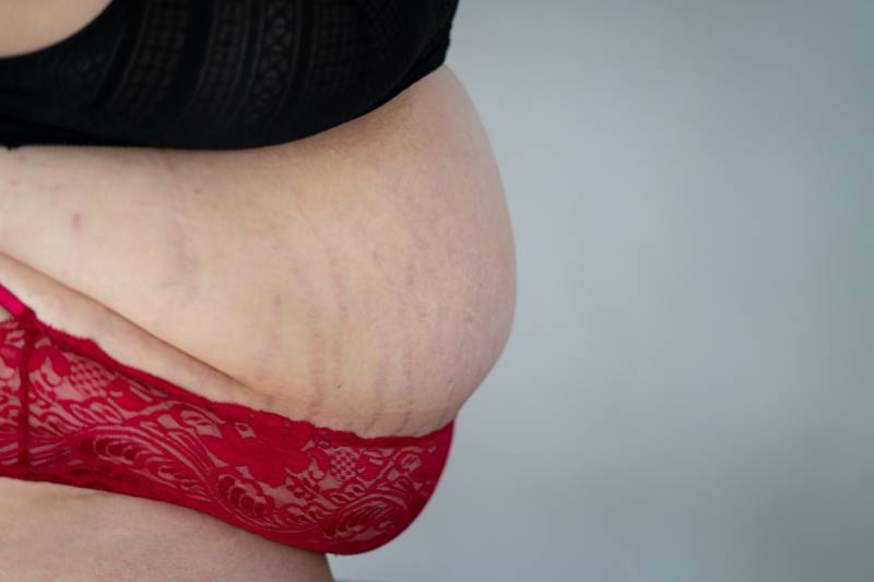 Nằm Giấc Mơ Thấy Người To Béo – Điềm Báo Tài Lộc Và Số Lô 3 Mơ thấy người to béo đánh con gì để trúng lớn?